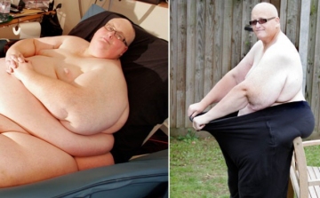 Három mázsát fogyott egy brit férfi, de még mindig 150 kiló