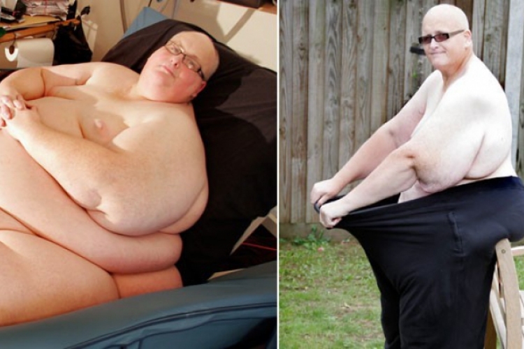 Három mázsát fogyott egy brit férfi, de még mindig 150 kiló